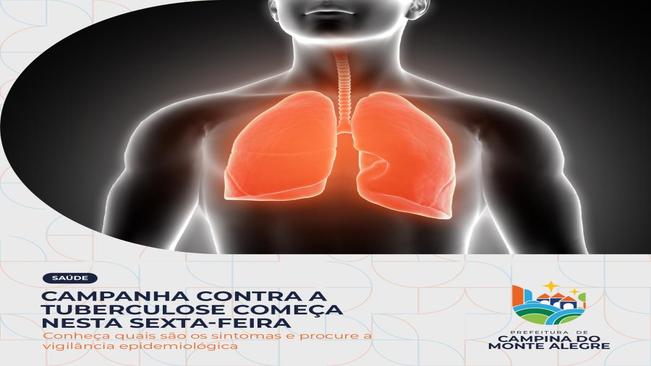 Campanha contra tuberculose começa nesta sexta-feira, das 8h às 11h30, no Posto de Saúde